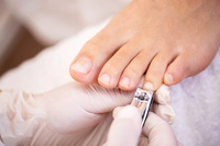 How To Remove an Ingrown Toenail Safely And Effectively At Home