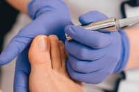 Effective Methods for Treating Ingrown Toenails